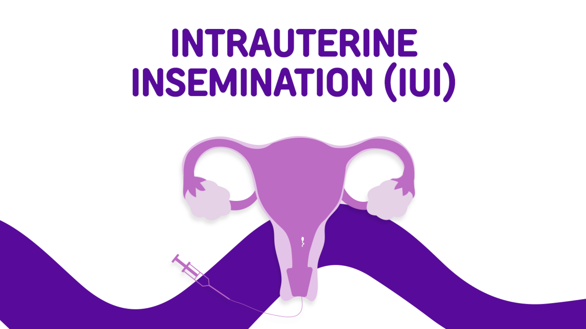 Intrauterine Insemination (IUI)