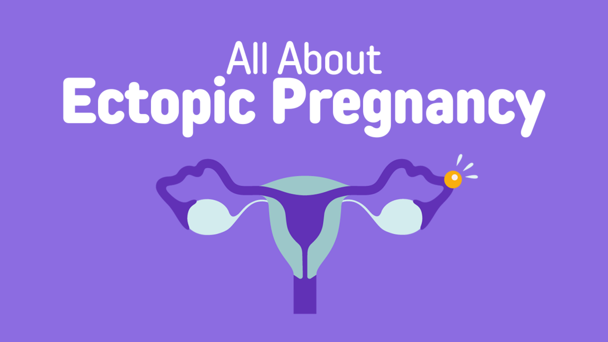 What is Ectopic Pregency
