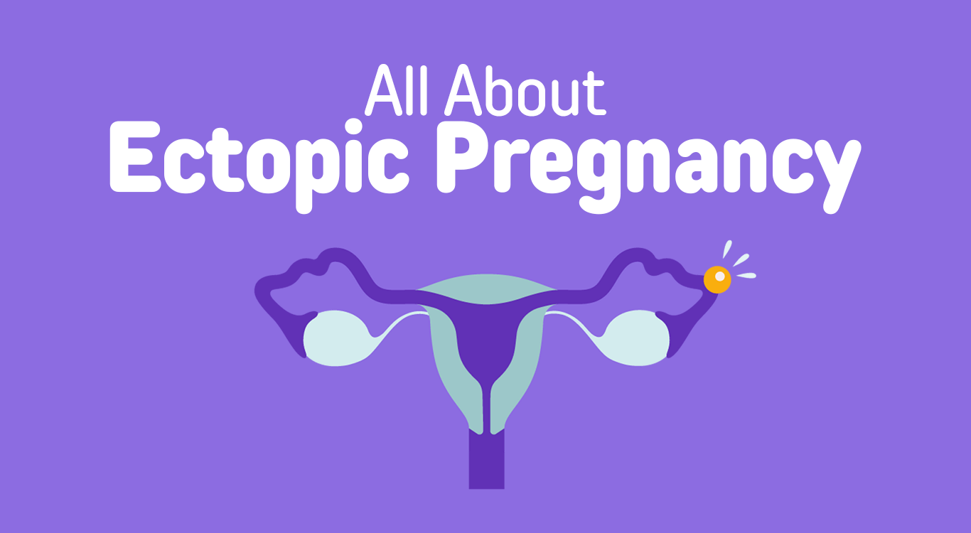 What is Ectopic Pregency