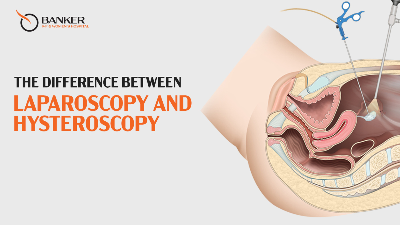 The Difference Between Laparoscopy and Hysteroscopy