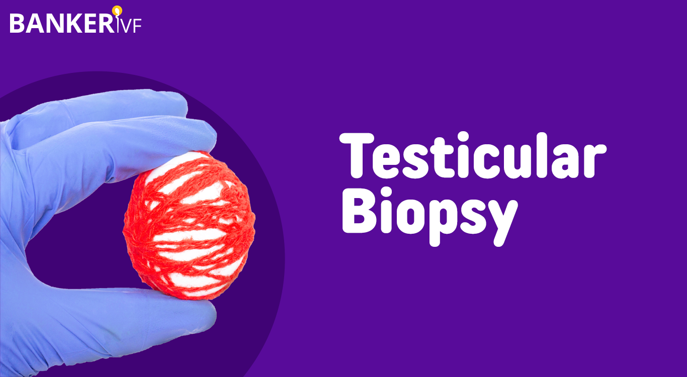 Testicular-Biopsy-Banker-IVF