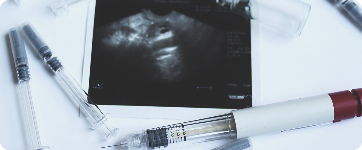 IUI embryo uitrasonic report