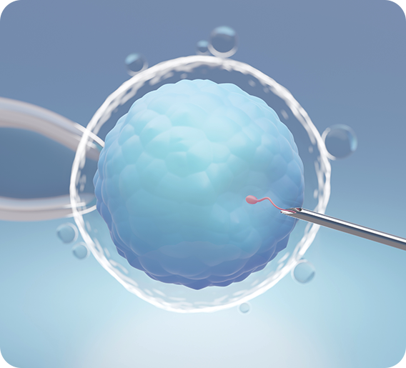 What is IVF – ICSI