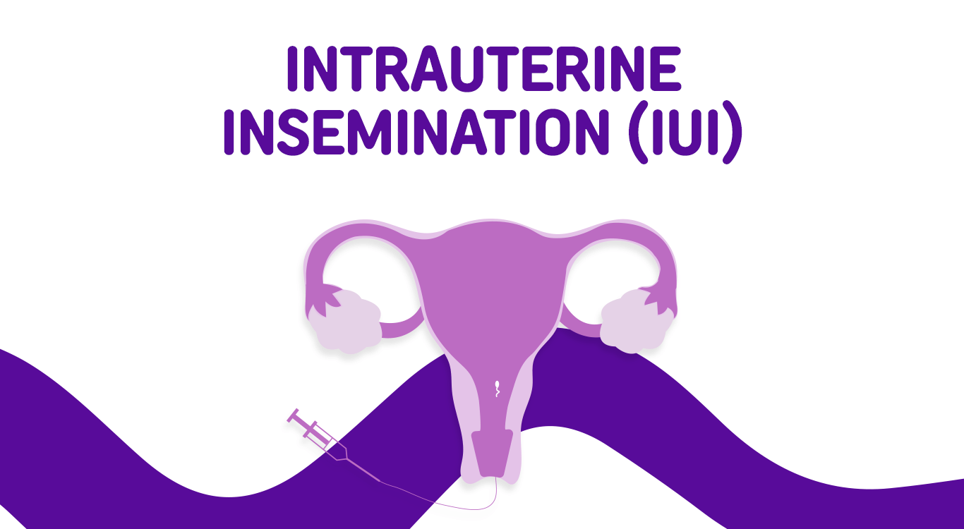 Intrauterine Insemination (IUI)