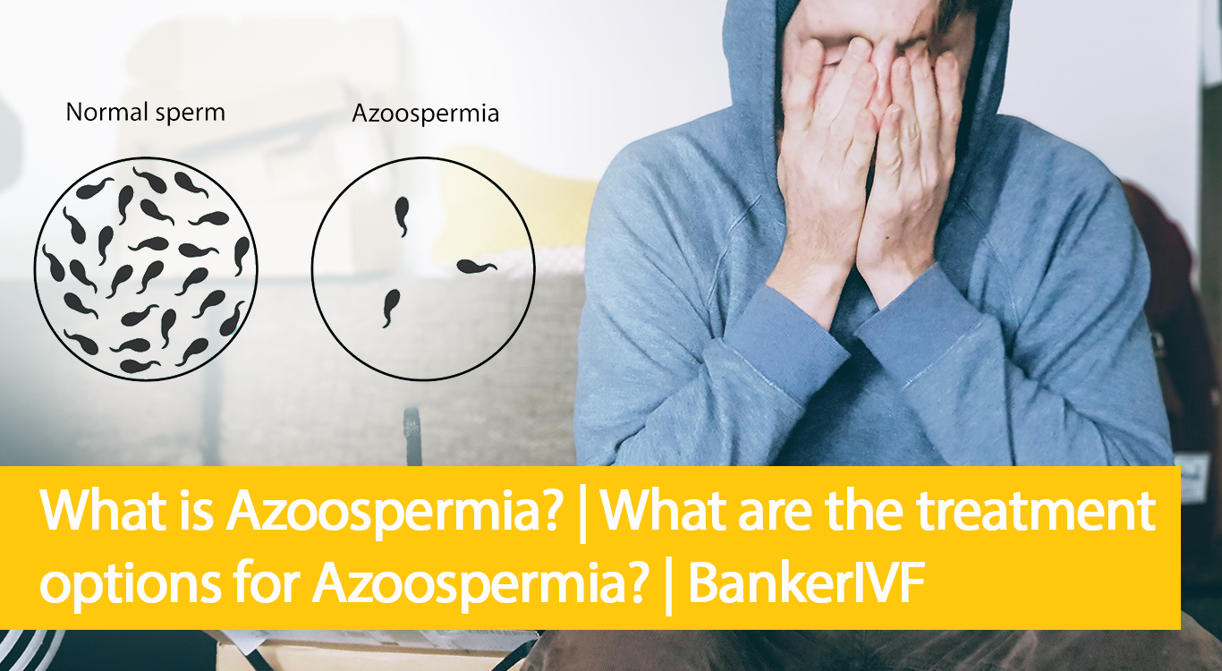 Azoospermia treatment