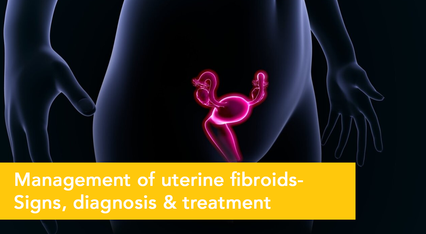 Uterine Fibroids