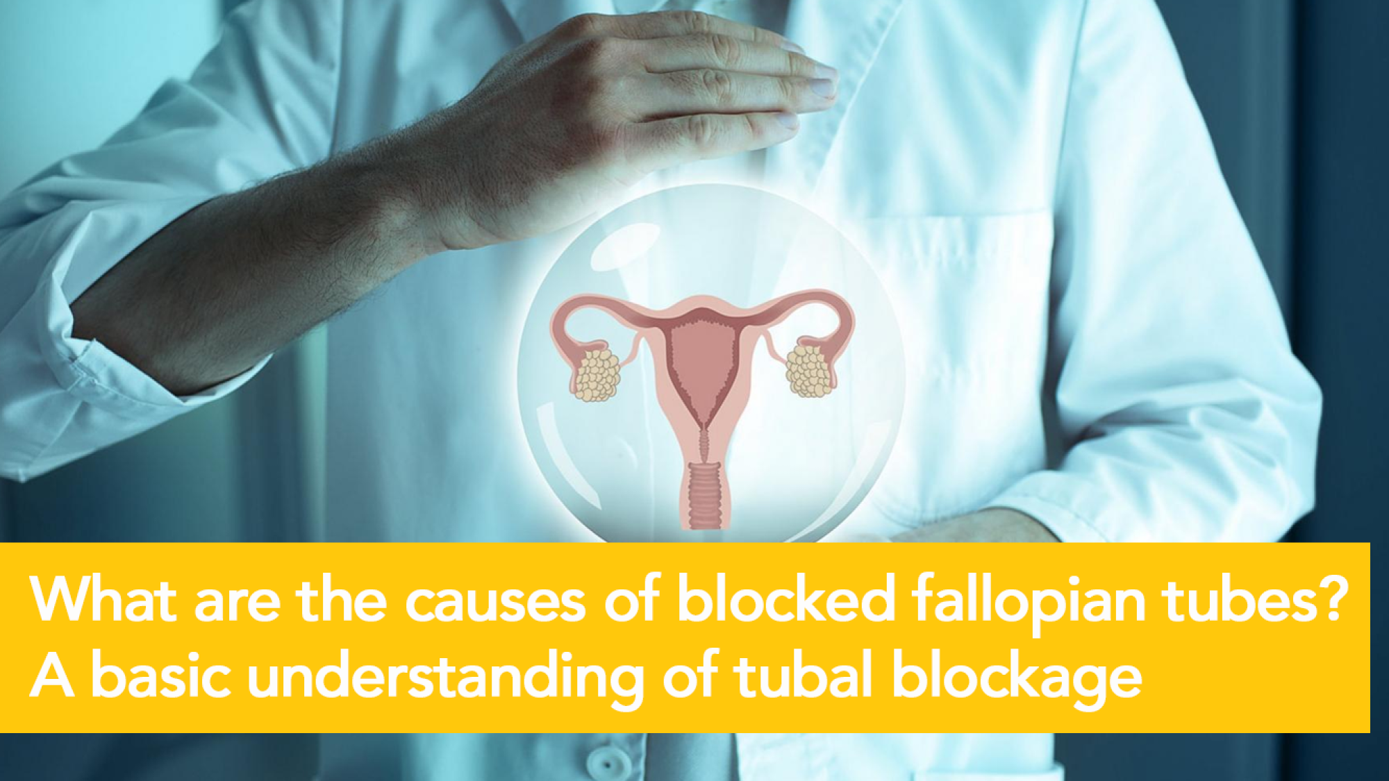 Blocked Fallopian TubeTreatments