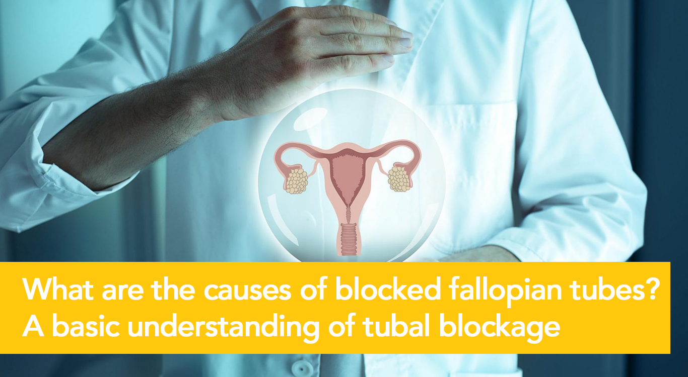 Blocked Fallopian TubeTreatments