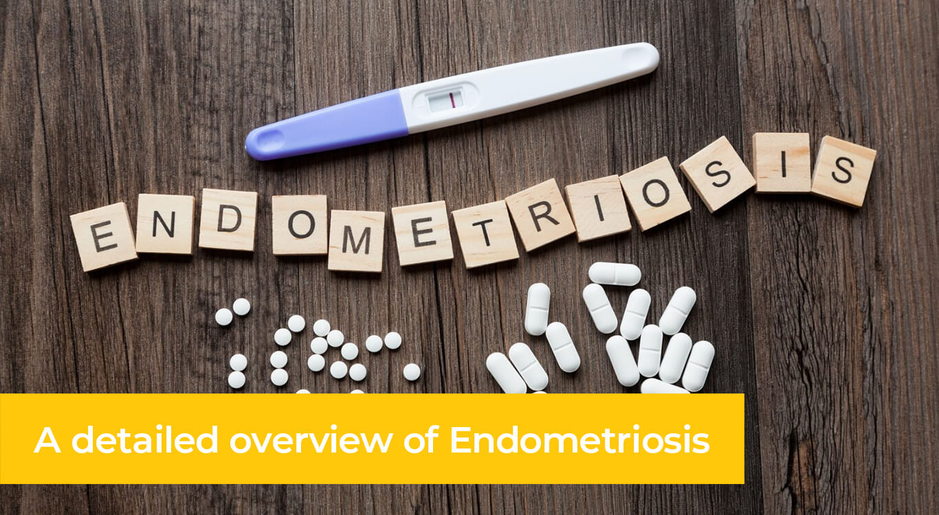 Endo_desk