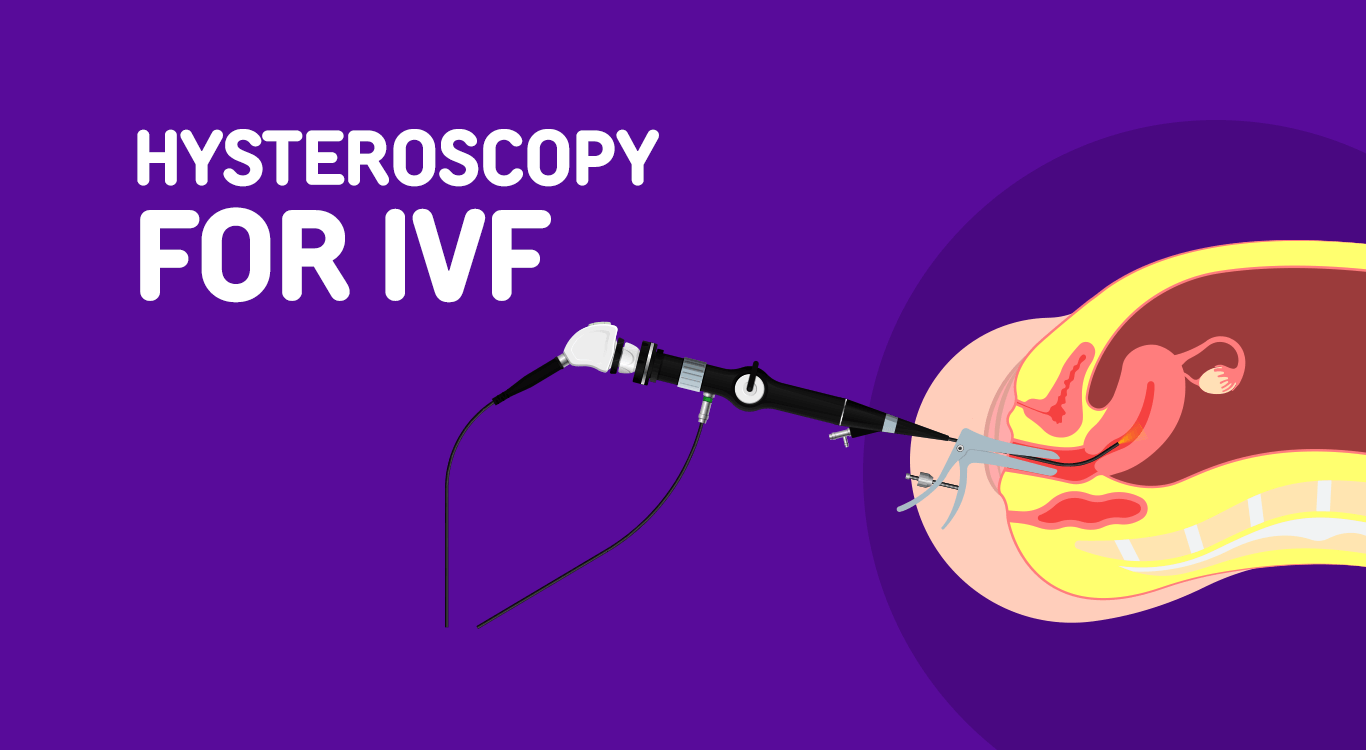 Hysteroscopy for IVF