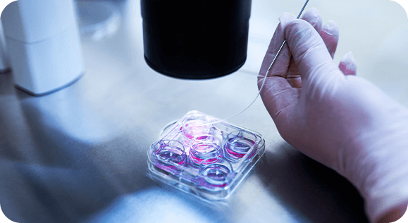 Donor IVF ICSI procedure