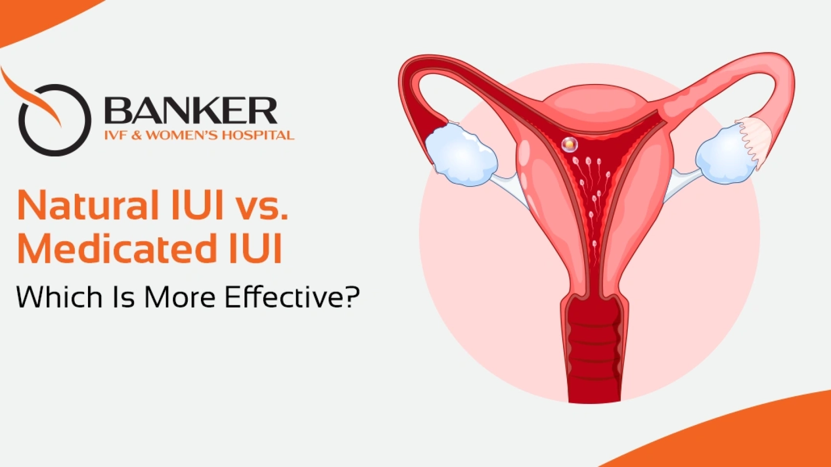 Natural IUI vs. Medicated IUI